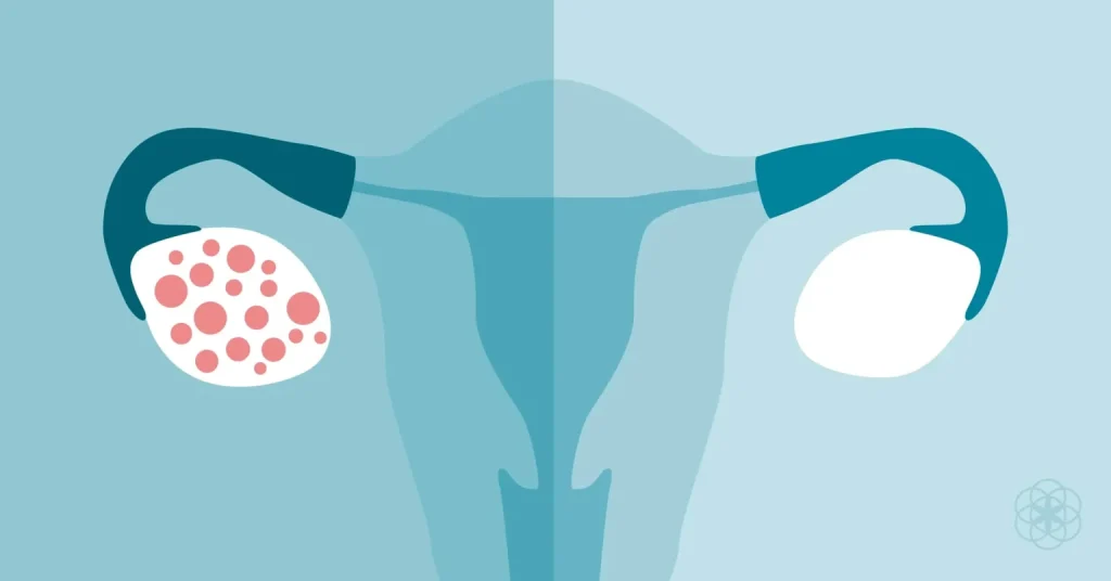 عرق بیدمشک درمان اختلالات قاعدگی و PCOS