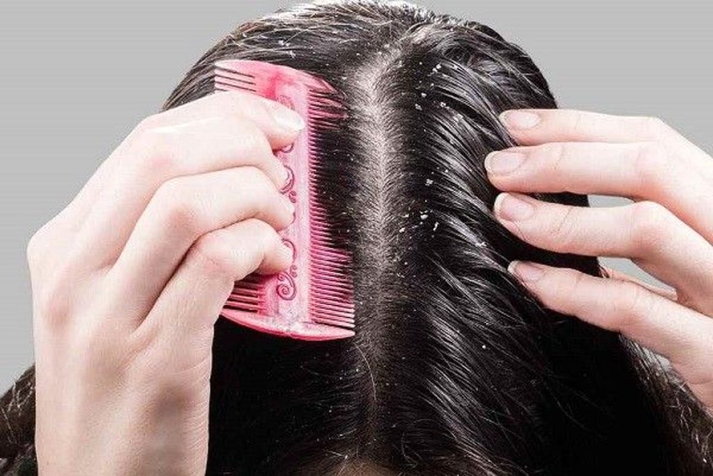 عرق بیدمشک برای جلوگیری از ریزش مو